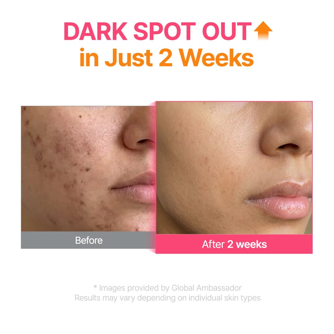 TXA 6% Niacinamide Serum