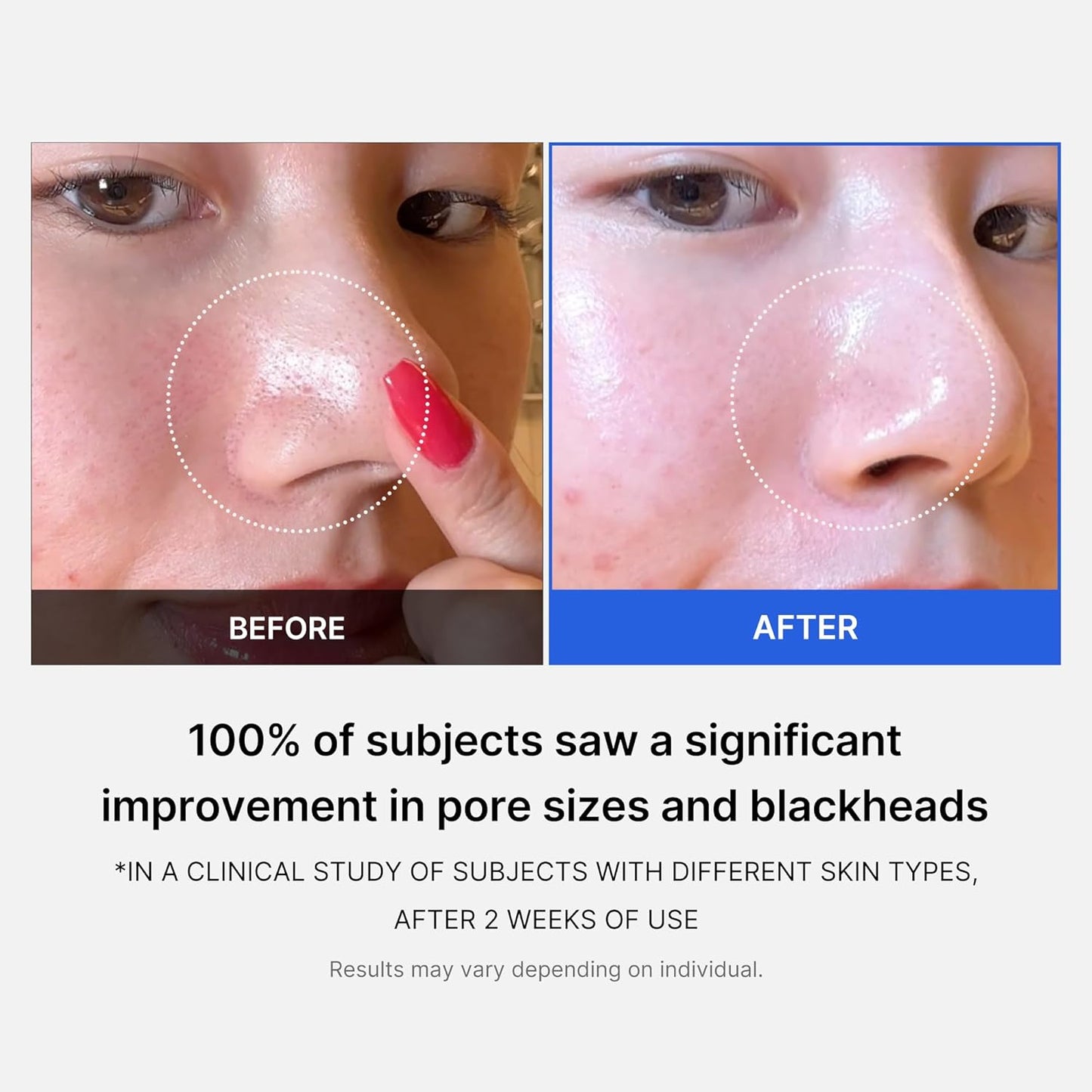 Zero Pore Pads