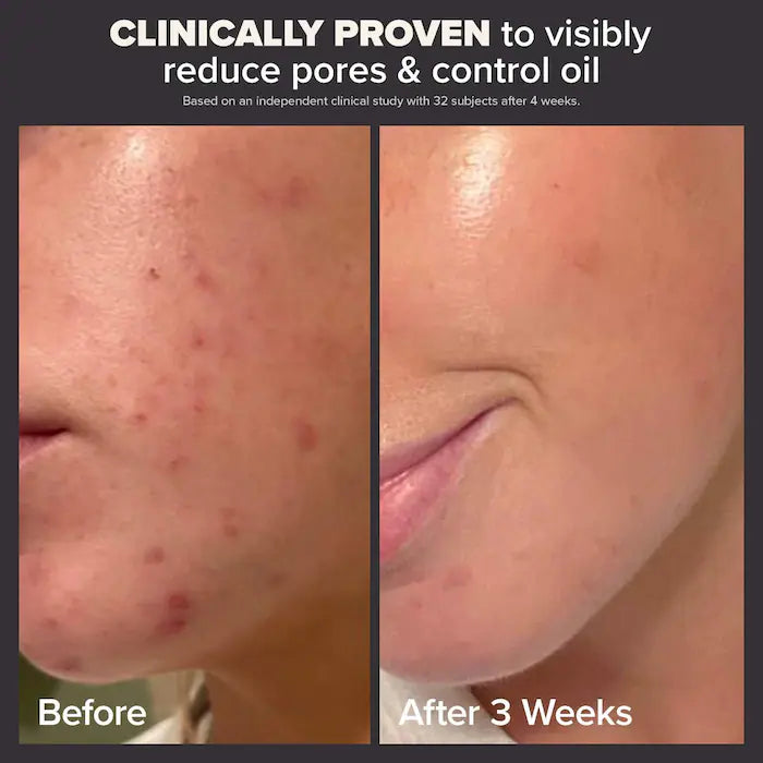 Mini Skin Perfecting 2% BHA Liquid Exfoliant