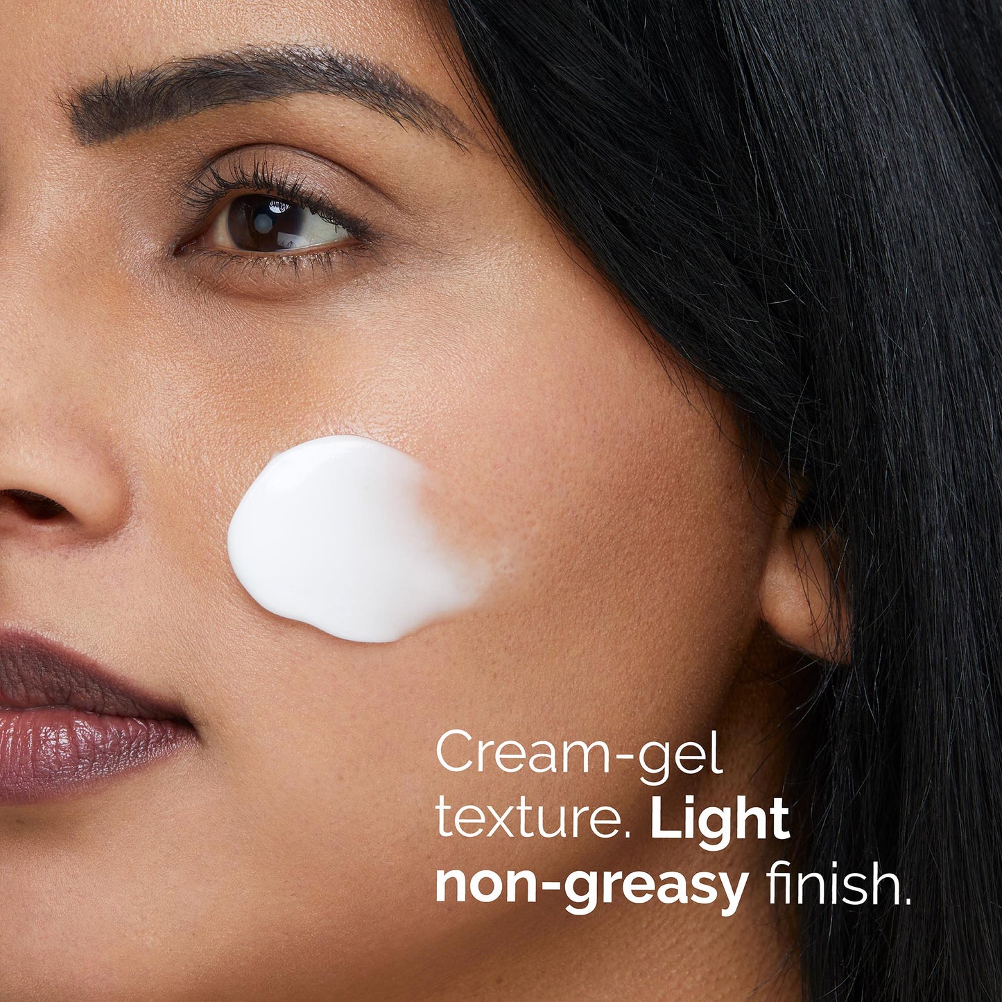 Azelaic Acid Suspension 10%